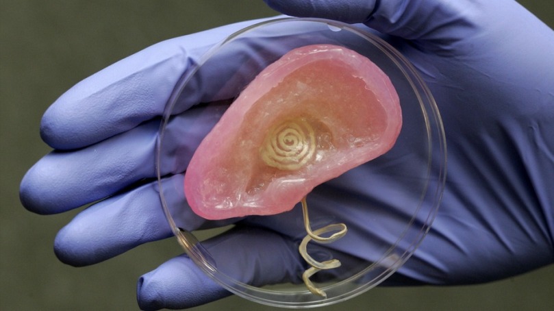 3D Printed Ear Cartilage, Source:  3dprintingindustry.com
